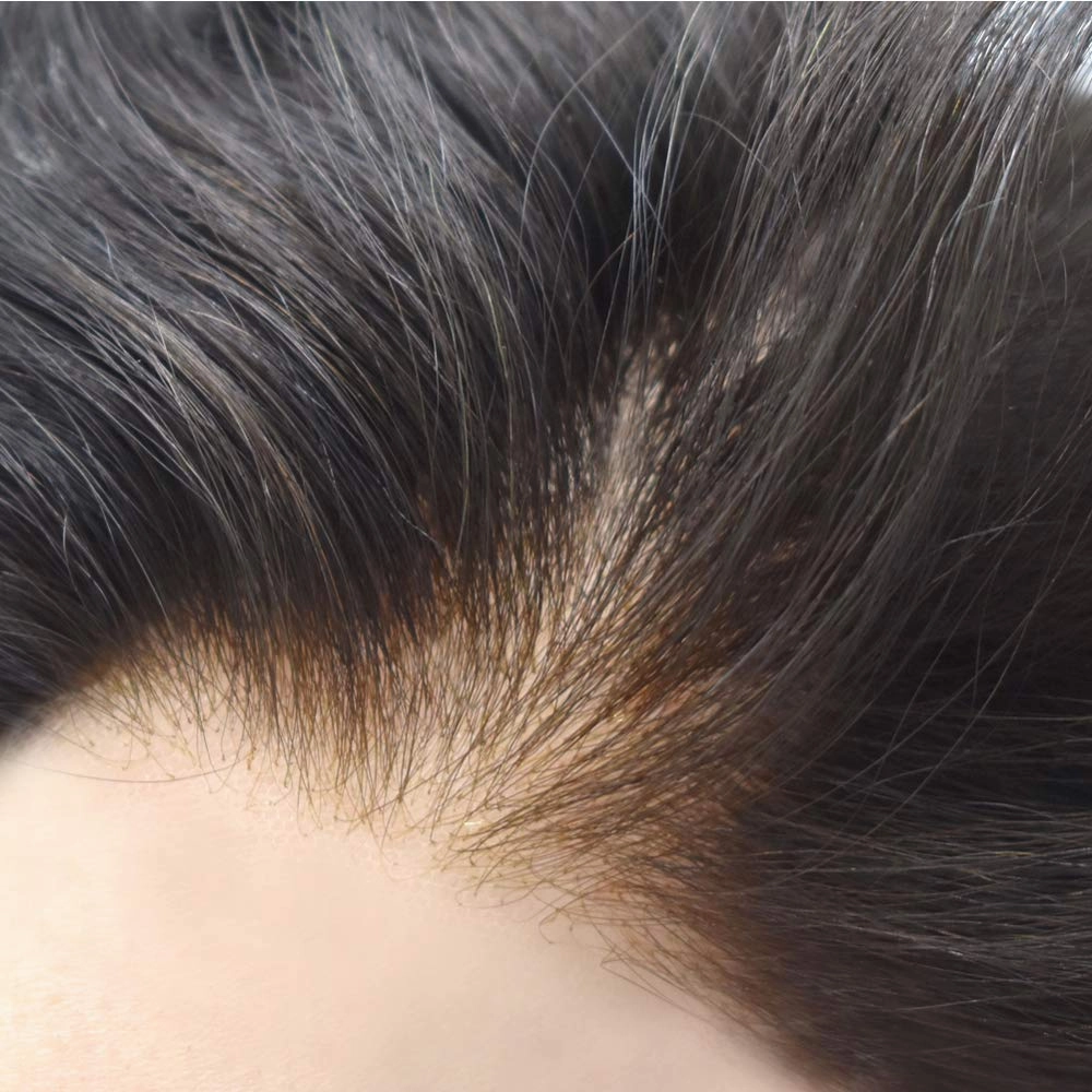 RESHE Mens Hair System French Lace Front Hair Pieces For Men Toupee For Men Real Human Hair Replacement System Slight Wavy Hand Tied Men's Hairpiece 7"X9"-90% Light density #2